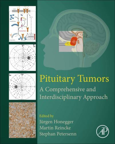 Pituitary Tumors A Comprehensive and Interdisciplinary Approach Honegger Reincke