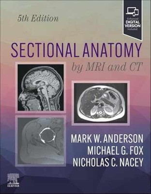 Sectional Anatomy by MRI and CT - Hardcover, by Anderson MD Mark W.; - Very Good