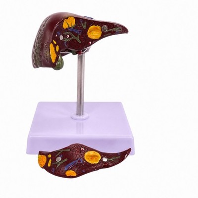Leberpathologie Lehrmodell kompaktes Leberpathologiemodell sicher für Labor