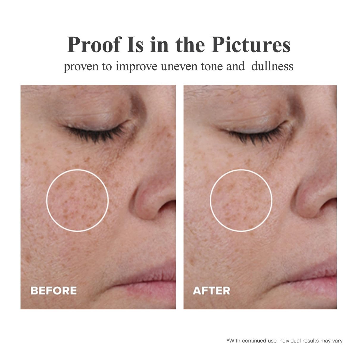 Triple Vitamin C Serum Capsules For Face: Dark Spots Correction with Camellia...