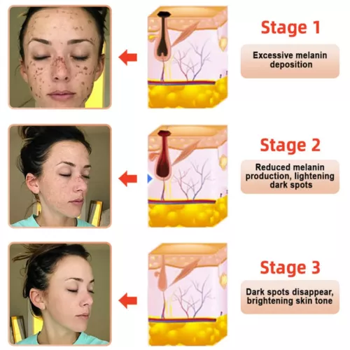 3X Purifying Exfoliating Gel, Quarxery Cleansing Purifying Cream for Face & Body - Bild 10 von 15