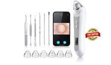 Eliminar las Espinillas Aspirador Para sacar Puntos Negros Removedor De Acne NEW