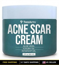 Acne Scar  Dark Spot Remover Cream for Face, 2 fl oz, Skin Treatment