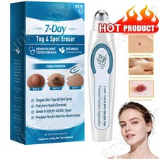 Tag  Spot Eraser Mole Skin Tags Remover Tool Eraser Pen Painless Long-Lasting