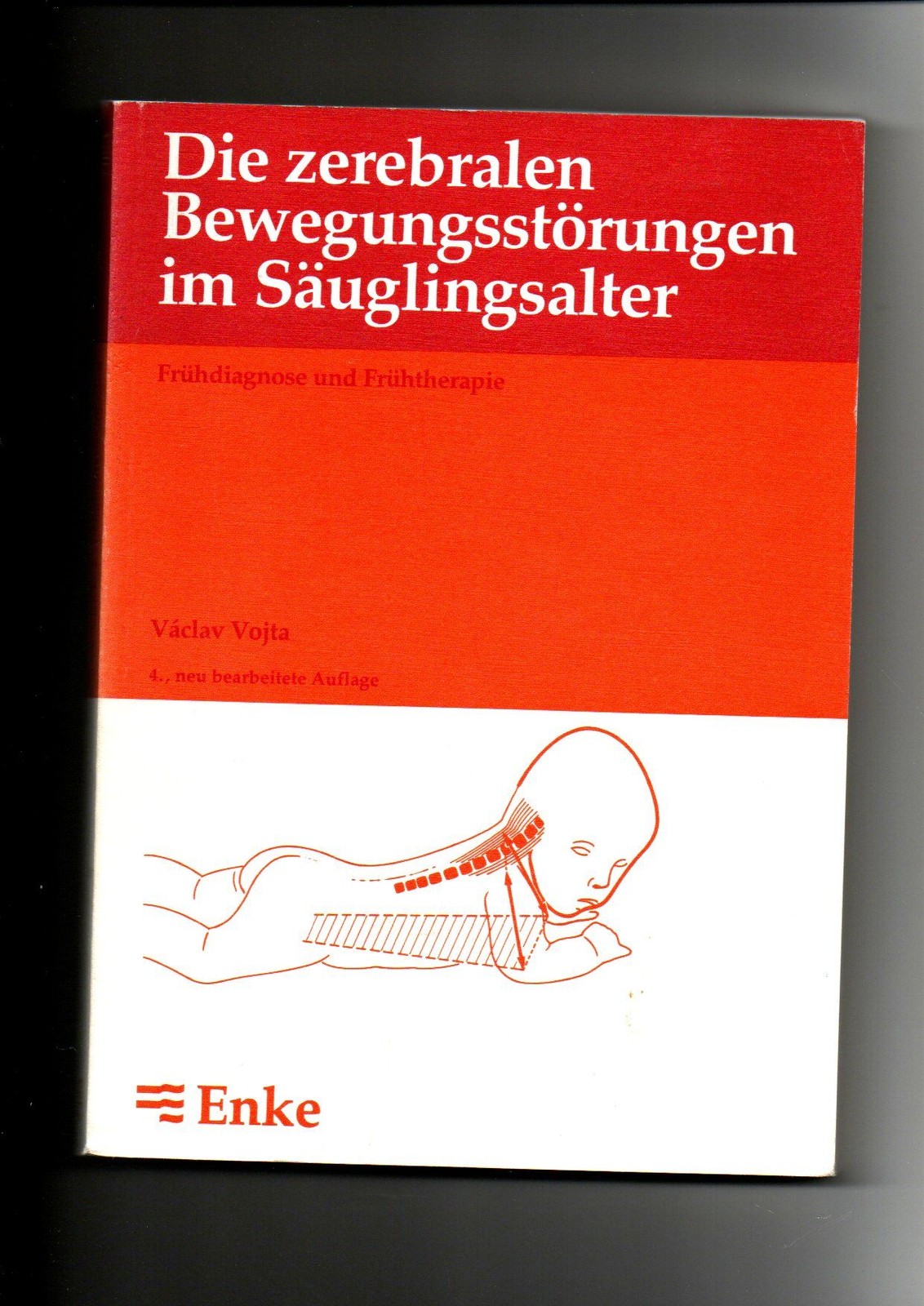 Vaclav Vojta, Die zerebralen Bewegungsstörungen im Säuglingsalter - Frühdiagnose