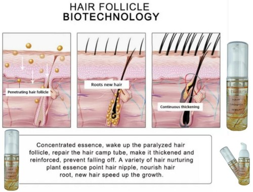 Grow Natural Gorgeous Hair Growth Density Serum Intense Hair Density in Weeks - Picture 5 of 12