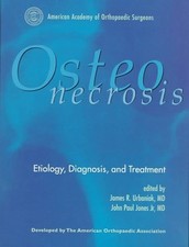Osteonecrosis: Etiology, Diagnosis, and Treat...