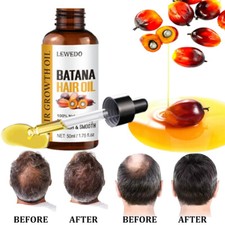 50ml Natural Batana Oil Serum for Hair Growth, Thicker Fuller Heal Thicker Hair