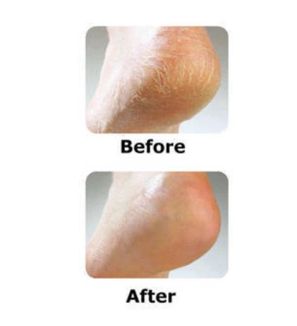 Softening heels best sale