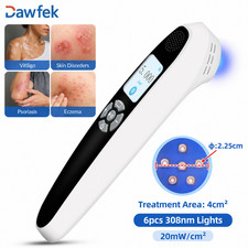 308nm UVB Phototherapy Lamp 6 Diodes 20mW/cm  Portable Home for Skin Diseases