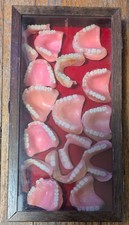 Dentures Vintage From Funeral Home Antique Used Probably Haunted 