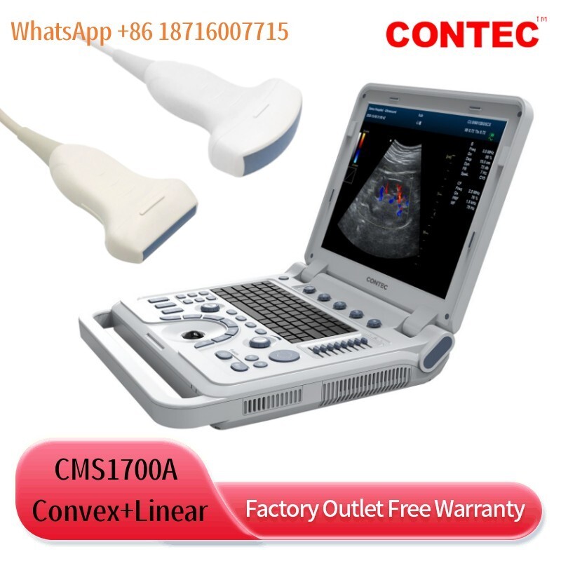 New Color Doppler Ultrasound Scanner Laptop Machine USG Diagnostic Convex+Linear
