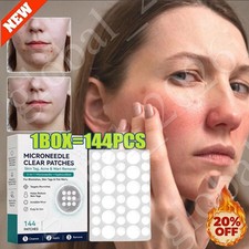 Curalona Microneedle Patches 144pcs, Skin Tag Wart Acne Remover Patches 20 OFF