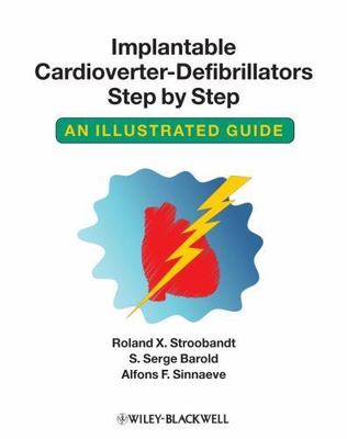 Implantable Cardioverter - Defibrillators Step by Step: An Illustrated Guide, St