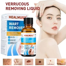 Wart Remover Liquid Skin Tag Mole Remover Eliminate Foot Corn Warts Unisex 30ML
