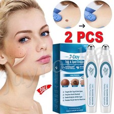 Skin Tag Remover,Tag and Spot Eraser,Skin Tag Dark Spot Remover HOT