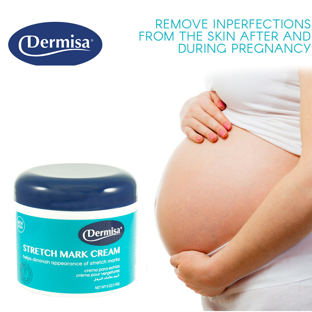 barmon stretch mark cream
