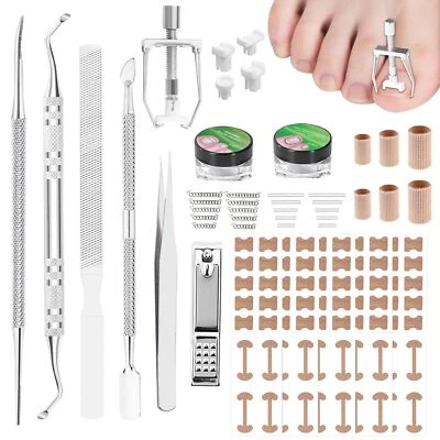 ‎JOYCABIN Eingewachsene Zehennägel Set Zehennagel Korrektur Patch Fußnägel Nagelzange Set