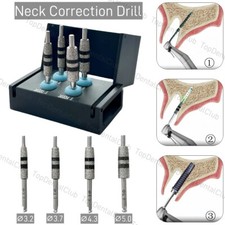 FG7604 Dental Implant Guided Neck Correction Drill Diamond Grinding Jawbone Tool