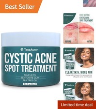Gentle Cystic Acne Spot Treatment - 20 Mins to Clear Skin, 120 Applications