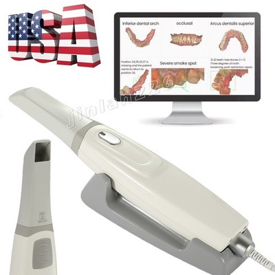 Dental Intraoral Scanner for CAD/CAM Dentistry