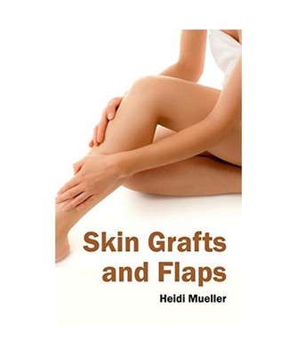 Skin Grafts and Flaps