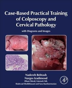 Case-Based Practical Training of Colposcopy and Cervical Pathology | englisch