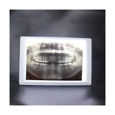 Lab Equipment X-Ray Film Illuminator Light Box X-ray Viewer Light Panel Screen