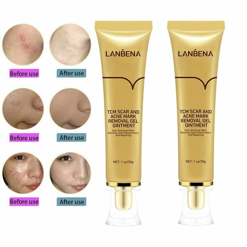 Lanbena scar removal deals