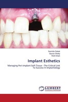 Samhita Dabak (U. A.) | Implant Esthetics | Taschenbuch | Englisch (2021)
