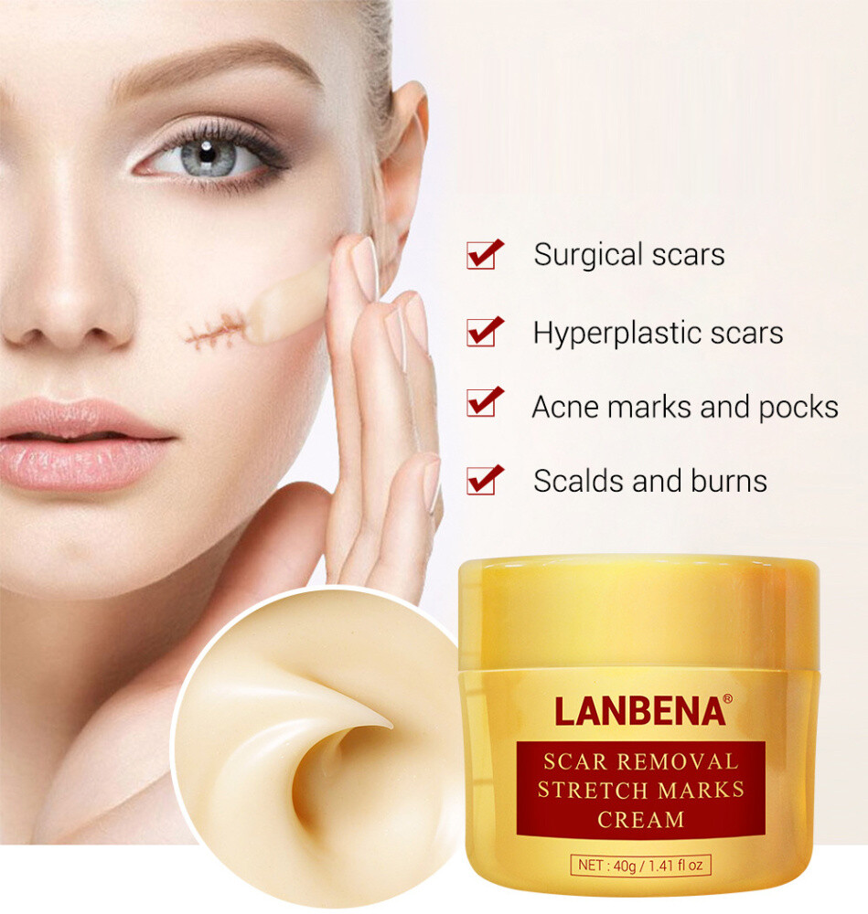 ointment for removing stretch marks