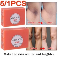 5/2X Kojic Acid Soap Dark Skin Clean Whitening Bleaching Lightening Brightening