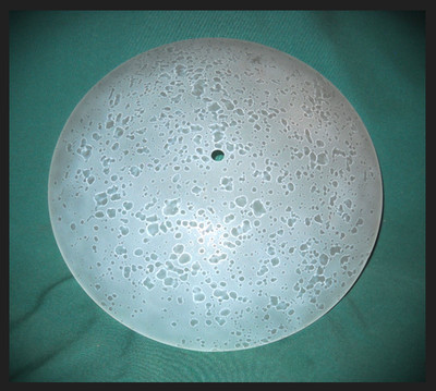 Acrylic Ceiling Light Shade 13'' Frosted Pebble Diffuser Dome *Center Post Mount