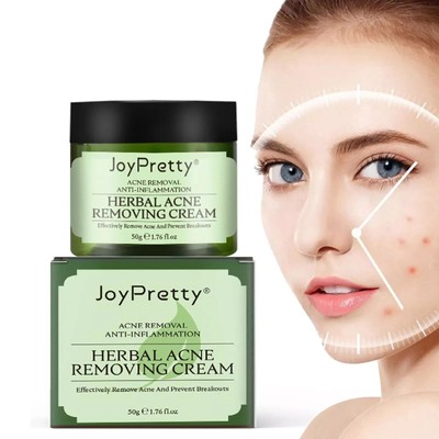 Crema facial para tratamiento natural del acné eliminan las marcas de acne 2024