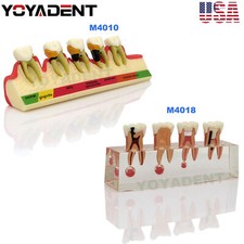 Dental Teeth Model Periodontal Disease Assort Model Endodontic Teaching Demo US