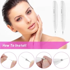 Adjustable Laser Pen Mole Removal Age Spot Remover Skin Wart Tattoo Tool