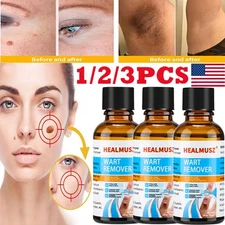 3/2X Wart Remover Liquid Skin Tag Mole Remover Eliminate Feet Corn Wart Removal