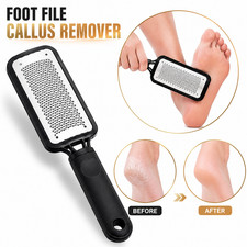 Foot Rasp File Pedicure Callus Remover Hard Dead Skin Scrubber Tool Feet Care US