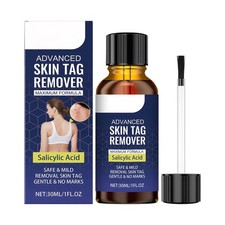 Fast-Acting Skin Tag Remover For Body And Neck - Natural, Mild Formula 30ml
