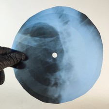 BOB DYLAN TONIGHT I'LL BE STAND X-Ray USSR Record Roentgen Bone Ribs Music Vinyl