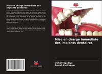 Vishal Tapadiya (U. A.) | Mise En Charge ImméDiate Des Implants Dentaires | Buch