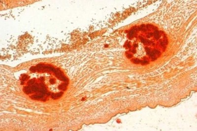 Microbiological stains: Safranine O (CI 50240 Basic red 2