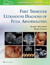 First Trimester Ultrasound Diagnosis of Fetal...