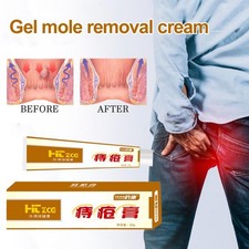 Gel Hemorrhoid Cream, Gel Mole Removal Cream Hemorrhoid Cream Care R0Q5