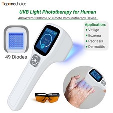 308nm UVB Phototherapy Device with LCD Screen for Skin Disorders Relief Home Use