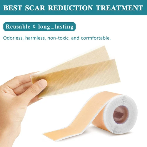 Silicone Gel Sheet Patch Medical Scar Removal Wound Skin Repair Treatment Tape - Picture 8 of 16