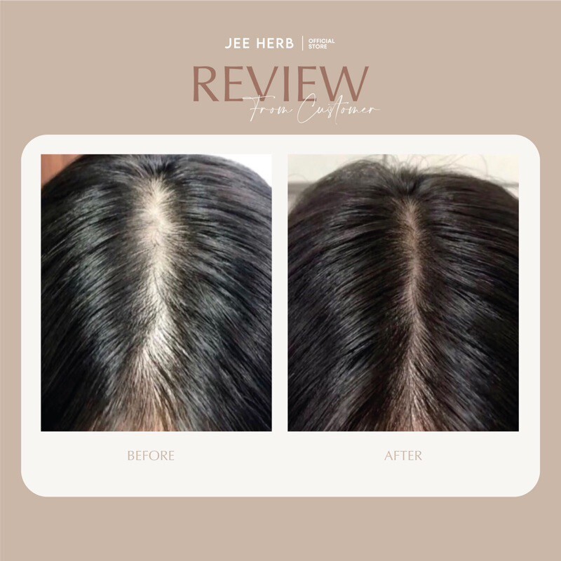 Set Jee Herb Shampoo + Hair Tonic + Hair Mask + Hair Oil Set Jee Herb Shampoo + Hair Tonic + Hair Mask + Hair Oil