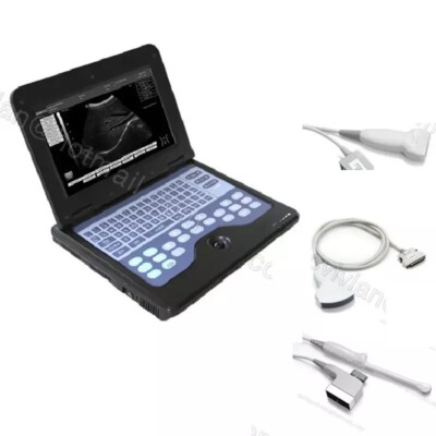 3 Probe Portable Laptop machine Digital ultrasound scanner Convex/Linear/Vaginal
