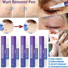 5pc 12 Hours Wart Remover Pen Eliminate Foot Corn Warts Skin Tag Remover Pen