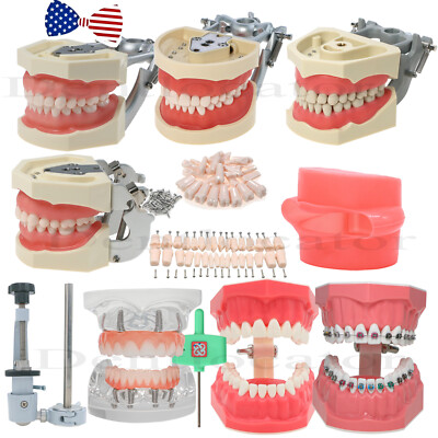 Dental Typodont Teeth Implant Model Pathological Perio Restoration Practice Demo